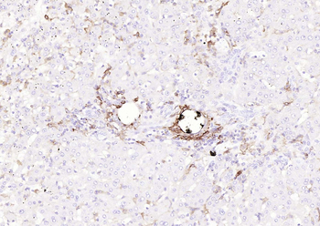 HLA-DR Recombinant Rabbit Monoclonal Antibody