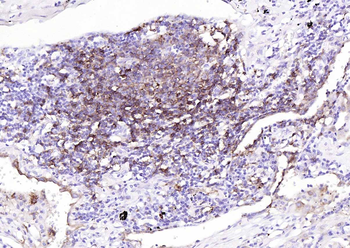 HLA-DR Recombinant Rabbit Monoclonal Antibody
