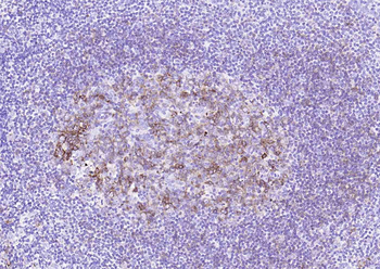 HLA-DR Recombinant Rabbit Monoclonal Antibody
