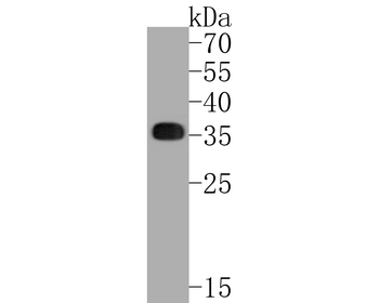 HLA-DR Recombinant Rabbit Monoclonal Antibody