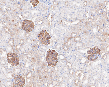 NPHS2 Recombinant Rabbit Monoclonal Antibody