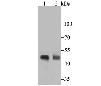 NPHS2 Recombinant Rabbit Monoclonal Antibody