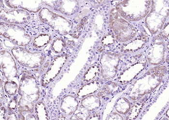 Phospho-MARK2 (Ser595) Rabbit Polyclonal Antibody