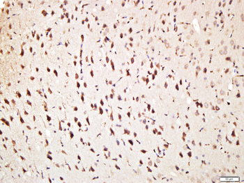 Phospho-MARK2 (Ser595) Rabbit Polyclonal Antibody