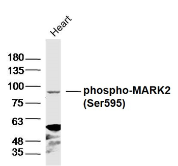 Phospho-MARK2 (Ser595) Rabbit Polyclonal Antibody