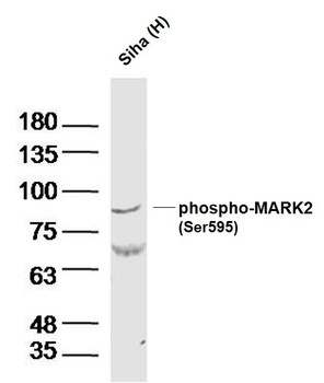Phospho-MARK2 (Ser595) Rabbit Polyclonal Antibody