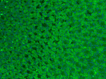 GLP-2 Rabbit Polyclonal Antibody