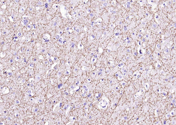 MBP Rabbit Polyclonal Antibody
