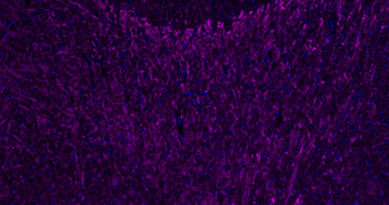 MBP Rabbit Polyclonal Antibody