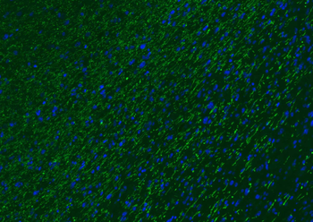MBP Rabbit Polyclonal Antibody