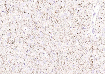 MBP Rabbit Polyclonal Antibody