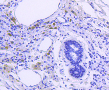 Phospho-GSK3 Alpha + Beta (Tyr279+Tyr216) Recombinant Rabbit Monoclonal Antibody