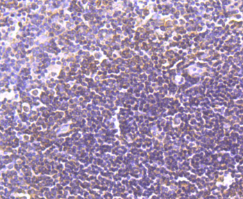LXR alpha Recombinant Rabbit Monoclonal Antibody