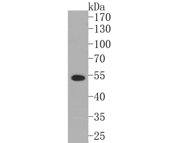 LXR alpha Recombinant Rabbit Monoclonal Antibody