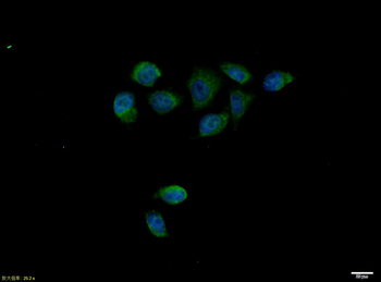 Phospho-Smad2 (Ser467) Rabbit Polyclonal Antibody