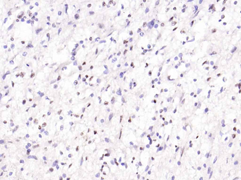 Phospho-Smad2 (Ser467) Rabbit Polyclonal Antibody