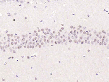 Phospho-Smad2 (Ser467) Rabbit Polyclonal Antibody