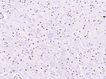 Phospho-Smad2 (Ser467) Rabbit Polyclonal Antibody