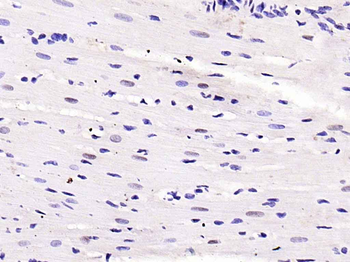 Phospho-Smad2 (Ser467) Rabbit Polyclonal Antibody
