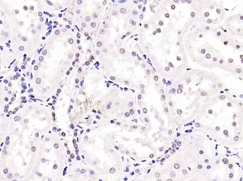 Phospho-Smad2 (Ser467) Rabbit Polyclonal Antibody