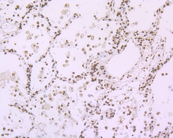 Histone H1.2 Recombinant Rabbit Monoclonal Antibody
