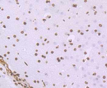 Histone H1.2 Recombinant Rabbit Monoclonal Antibody