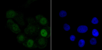 Histone H1.2 Recombinant Rabbit Monoclonal Antibody