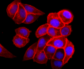 EGFR Recombinant Rabbit Monoclonal Antibody