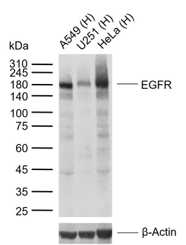 EGFR Recombinant Rabbit Monoclonal Antibody