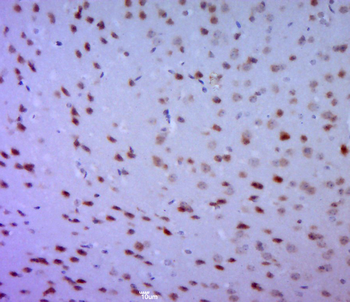 Phospho-ERK1 (Thr202/Tyr204) + ERK2 (Thr183/Tyr185) Rabbit Polyclonal Antibody