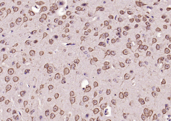 Phospho-ERK1 (Thr202/Tyr204) + ERK2 (Thr183/Tyr185) Rabbit Polyclonal Antibody