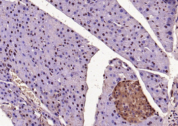 Phospho-ERK1 (Thr202/Tyr204) + ERK2 (Thr183/Tyr185) Rabbit Polyclonal Antibody