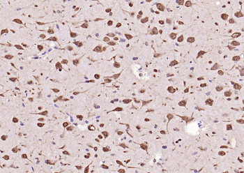 Phospho-ERK1 (Thr202/Tyr204) + ERK2 (Thr183/Tyr185) Rabbit Polyclonal Antibody
