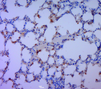 Phospho-ERK1 (Thr202/Tyr204) + ERK2 (Thr183/Tyr185) Rabbit Polyclonal Antibody