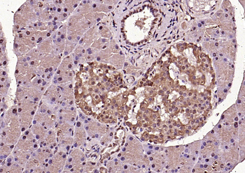 Phospho-ERK1 (Thr202/Tyr204) + ERK2 (Thr183/Tyr185) Rabbit Polyclonal Antibody