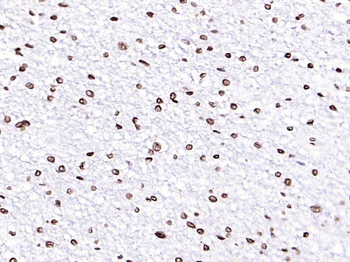 Lamin A/C Mouse Monoclonal Antibody