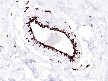 Lamin A/C Mouse Monoclonal Antibody