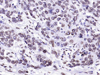 Lamin A/C Mouse Monoclonal Antibody