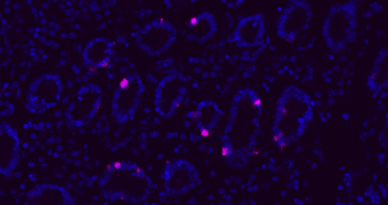 Donkey Anti-Rabbit IgG H&L, Cy5 conjugated