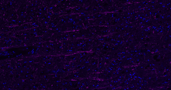 Donkey Anti-Rabbit IgG H&L, Cy5 conjugated