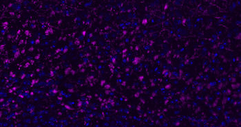 Donkey Anti-Rabbit IgG H&L, Cy5 conjugated