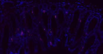 Donkey Anti-Rabbit IgG H&L, Cy5 conjugated