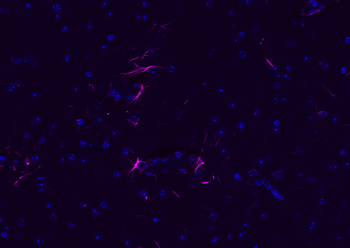 GFAP Rabbit Polyclonal Antibody (Cy5)