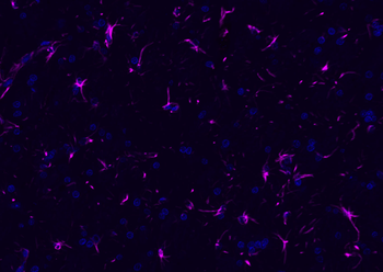 GFAP Rabbit Polyclonal Antibody (Cy5)