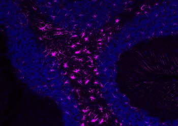GFAP Rabbit Polyclonal Antibody (Cy5)