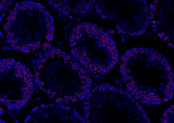 Estrogen Receptor alpha Rabbit Polyclonal Antibody (Cy5)