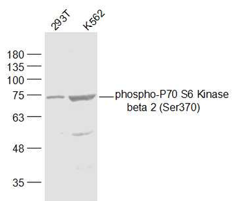 Phospho-P70 S6 Kinase beta 2 (Ser370) Rabbit Polyclonal Antibody