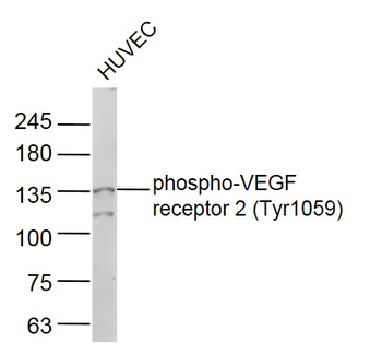 Phospho-VEGF receptor 2 (Tyr1059) Rabbit Polyclonal Antibody