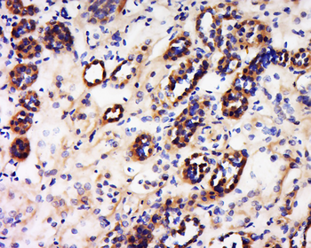 Phospho-VEGF receptor 2 (Tyr1059) Rabbit Polyclonal Antibody