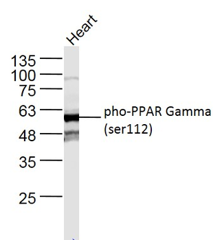 Phospho-PPAR Gamma (Ser112) Rabbit Polyclonal Antibody